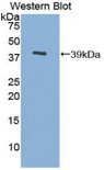 MT3 / Metallothionein 3 Antibody - Western blot of recombinant MT3 / Metallothionein 3.  This image was taken for the unconjugated form of this product. Other forms have not been tested.