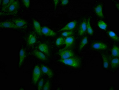 MT3 / Metallothionein 3 Antibody - Immunofluorescence staining of Hela cells at a dilution of 1:133, counter-stained with DAPI. The cells were fixed in 4% formaldehyde, permeabilized using 0.2% Triton X-100 and blocked in 10% normal Goat Serum. The cells were then incubated with the antibody overnight at 4 °C.The secondary antibody was Alexa Fluor 488-congugated AffiniPure Goat Anti-Rabbit IgG (H+L) .