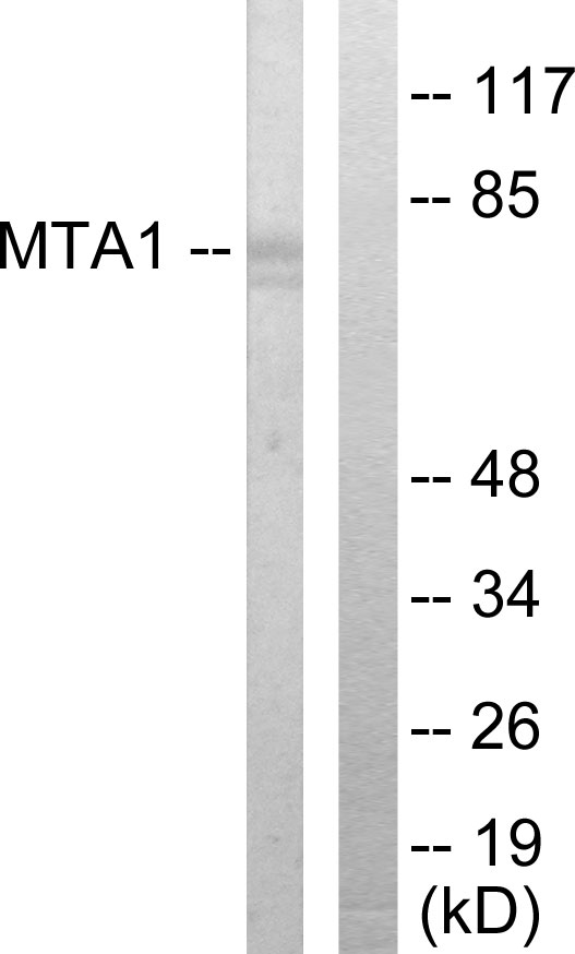 MTA1 Antibody - Western blot analysis of lysates from Jurkat cells, using MTA1 Antibody. The lane on the right is blocked with the synthesized peptide.
