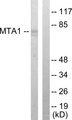 MTA1 Antibody - Western blot analysis of lysates from Jurkat cells, using MTA1 Antibody. The lane on the right is blocked with the synthesized peptide.