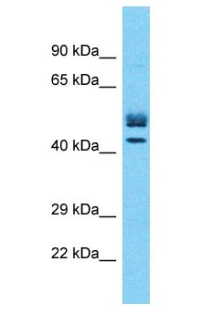 MTA1 Antibody - MTA1 antibody Western Blot of Thymus Tumor. Antibody dilution: 1 ug/ml.  This image was taken for the unconjugated form of this product. Other forms have not been tested.