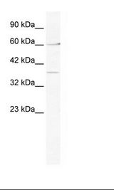 MTA1 Antibody - Jurkat Cell Lysate.  This image was taken for the unconjugated form of this product. Other forms have not been tested.