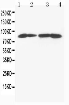 MTA1 Antibody - WB of MTA1 antibody. All lanes: Anti-MTA1 at 0.5ug/ml. Lane 1: MCF-7 Whole Cell Lysate at 40ug. Lane 2: HELA Whole Cell Lysate at 40ug. Lane 3: JURKAT Whole Cell Lysate at 40ug. Lane 4: CEM Whole Cell Lysate at 40ug. Predicted bind size: 81KD. Observed bind size: 81KD.