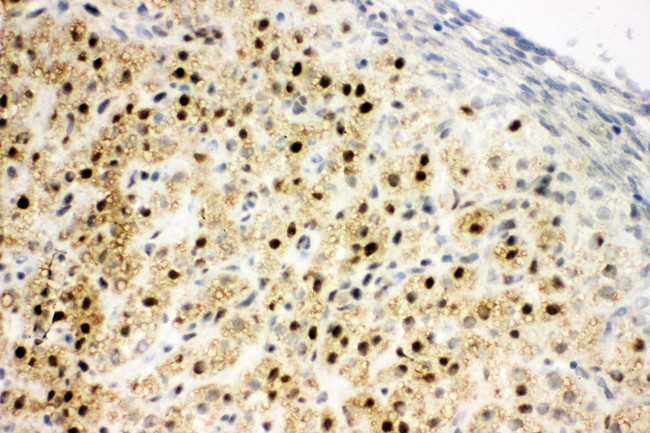 MTA1 Antibody - MTA1 antibody. IHC(F): Rat Ovary Tissue Lysate.