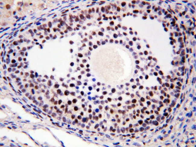 MTA1 Antibody - IHC analysis of MTA1 using anti-MTA1 antibody. MTA1 was detected in paraffin-embedded section of rat ovary tissues. Heat mediated antigen retrieval was performed in citrate buffer (pH6, epitope retrieval solution) for 20 mins. The tissue section was blocked with 10% goat serum. The tissue section was then incubated with 1µg/ml rabbit anti-MTA1Antibody overnight at 4°C. Biotinylated goat anti-rabbit IgG was used as secondary antibody and incubated for 30 minutes at 37°C. The tissue section was developed using Strepavidin-Biotin-Complex (SABC) with DAB as the chromogen.