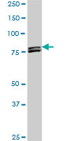 MTA1 Antibody - MTA1 monoclonal antibody (M01), clone 4D5. Western blot of MTA1 expression in PC-12.