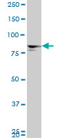 MTA1 Antibody - MTA1 monoclonal antibody (M01), clone 4D5. Western blot of MTA1 expression in IMR-32.