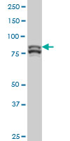 MTA1 Antibody - MTA1 monoclonal antibody (M01), clone 4D5 Western blot of MTA1 expression in HeLa NE.
