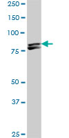 MTA1 Antibody - MTA1 monoclonal antibody (M01), clone 4D5. Western blot of MTA1 expression in NIH/3T3.