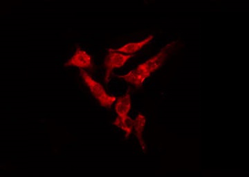 MTA1 Antibody - Staining HeLa cells by IF/ICC. The samples were fixed with PFA and permeabilized in 0.1% Triton X-100, then blocked in 10% serum for 45 min at 25°C. The primary antibody was diluted at 1:200 and incubated with the sample for 1 hour at 37°C. An Alexa Fluor 594 conjugated goat anti-rabbit IgG (H+L) Ab, diluted at 1/600, was used as the secondary antibody.