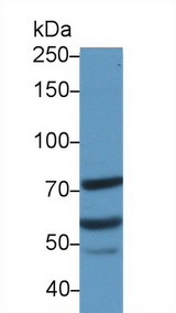 MTA2 Antibody - Western Blot; Sample: Human Jurkat cell lysate; Primary Ab: 1µg/ml Rabbit Anti-Human MTA2 Antibody Second Ab: 0.2µg/mL HRP-Linked Caprine Anti-Rabbit IgG Polyclonal Antibody