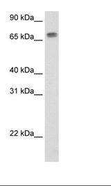 MTA2 Antibody - SP2/0 Cell Lysate.  This image was taken for the unconjugated form of this product. Other forms have not been tested.