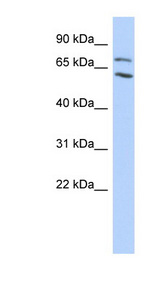 MTA2 Antibody - MTA2 antibody Western blot of Transfected 293T cell lysate. This image was taken for the unconjugated form of this product. Other forms have not been tested.