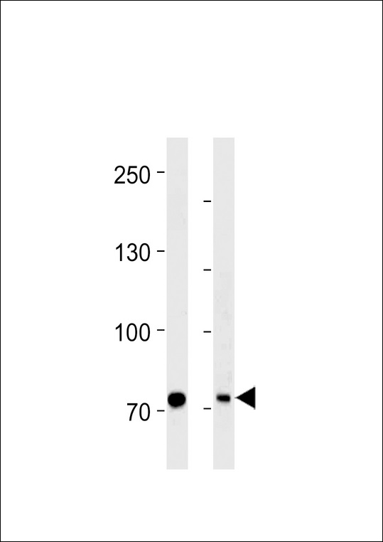 MTA2 Antibody - PID/MTA2 Antibody western blot of HeLa cell line and mouse brain tissue lysates (35 ug/lane). The PID/MTA2 antibody detected the PID/MTA2 protein (arrow).