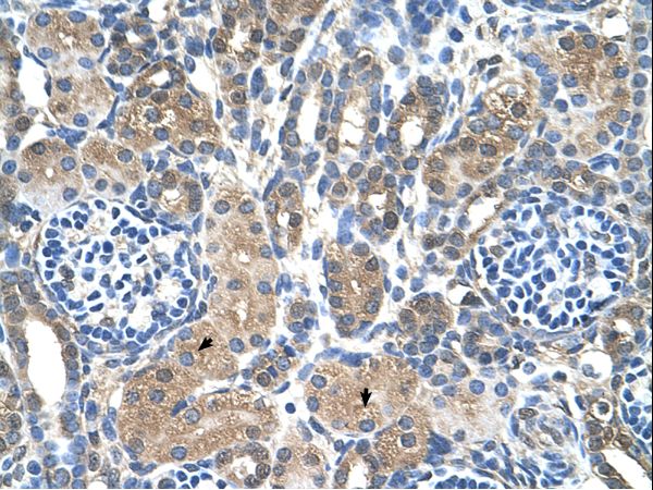 MTA2 Antibody - MTA2 antibody ARP43599_T100-NP_004730-MTA2(metastasis associated 1 family, member 2) Antibody was used in IHC to stain formalin-fixed, paraffin-embedded human kidney.  This image was taken for the unconjugated form of this product. Other forms have not been tested.