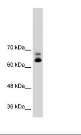 MTA2 Antibody - Jurkat Cell Lysate.  This image was taken for the unconjugated form of this product. Other forms have not been tested.