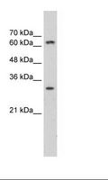 MTA2 Antibody - Transfected 293T Cell Lysate.  This image was taken for the unconjugated form of this product. Other forms have not been tested.
