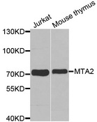 MTA2 Antibody - Western blot analysis of extracts of various cell lines, using MTA2 antibody.
