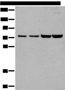 MTA2 Antibody - Western blot analysis of 293T and Hela cell lysates  using MTA2 Polyclonal Antibody at dilution of 1:400