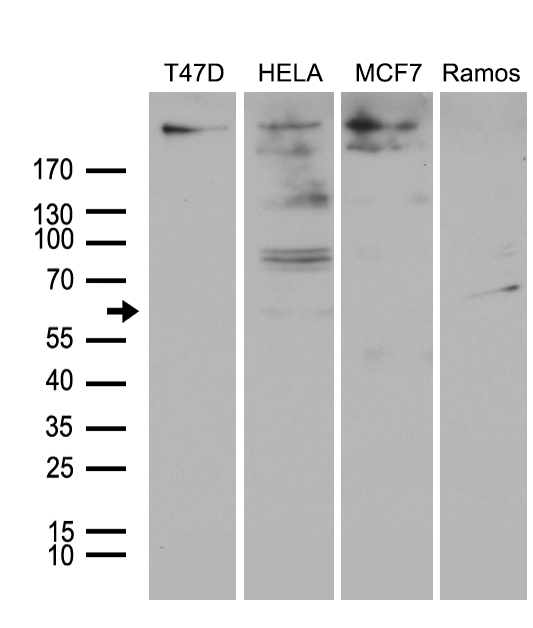 MTA3 Antibody - Western blot analysis of extracts. (35ug) from 4 different cell lines by using anti-MTA3 monoclonal antibody. (1:500)