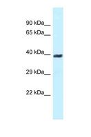MTA3 Antibody - Western blot of Human Jurkat. MTA3 antibody dilution 1.0 ug/ml.  This image was taken for the unconjugated form of this product. Other forms have not been tested.