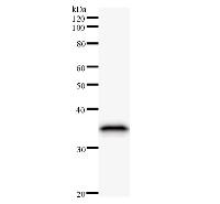 MTA3 Antibody - Western blot analysis of immunized recombinant protein, using anti-MTA3 monoclonal antibody.