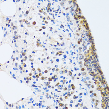 MTA3 Antibody - Immunohistochemistry of paraffin-embedded rat lung tissue.