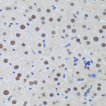 MTA3 Antibody - Immunohistochemistry of paraffin-embedded rat liver tissue.