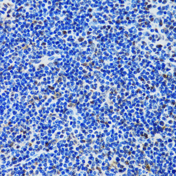 MTA3 Antibody - Immunohistochemistry of paraffin-embedded rat spleen tissue.