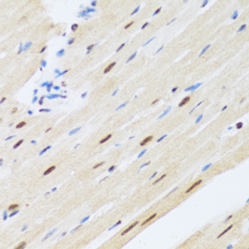 MTA3 Antibody - Immunohistochemistry of paraffin-embedded rat heart tissue.