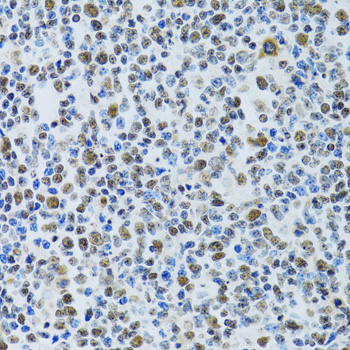 MTA3 Antibody - Immunohistochemistry of paraffin-embedded human tonsil tissue.