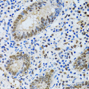 MTA3 Antibody - Immunohistochemistry of paraffin-embedded human vermiform appendix tissue.