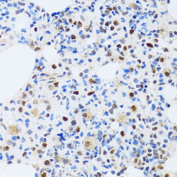 MTA3 Antibody - Immunohistochemistry of paraffin-embedded mouse lung tissue.