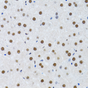 MTA3 Antibody - Immunohistochemistry of paraffin-embedded mouse liver tissue.