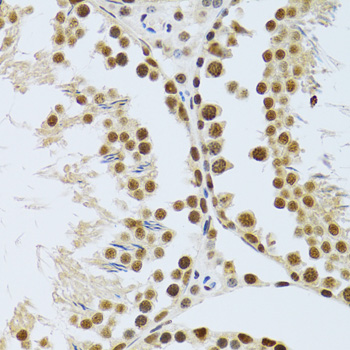 MTA3 Antibody - Immunohistochemistry of paraffin-embedded mouse testis tissue.