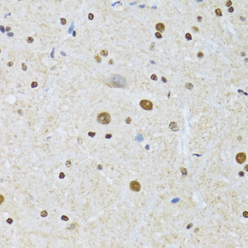 MTA3 Antibody - Immunohistochemistry of paraffin-embedded mouse spinal cord tissue.