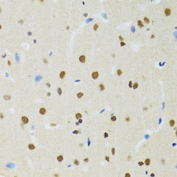 MTA3 Antibody - Immunohistochemistry of paraffin-embedded mouse brain tissue.