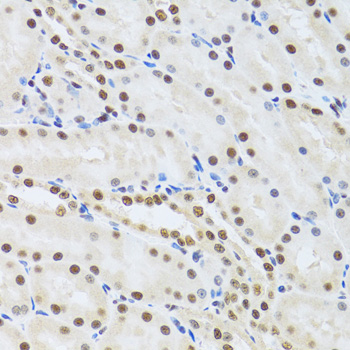 MTA3 Antibody - Immunohistochemistry of paraffin-embedded mouse kidney tissue.