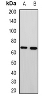 MTA3 Antibody - Western blot analysis of MTA3 expression in HepG2 (A); A549 (B) whole cell lysates.