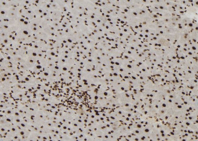 MTA3 Antibody - 1:100 staining mouse liver tissue by IHC-P. The sample was formaldehyde fixed and a heat mediated antigen retrieval step in citrate buffer was performed. The sample was then blocked and incubated with the antibody for 1.5 hours at 22°C. An HRP conjugated goat anti-rabbit antibody was used as the secondary.