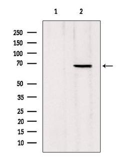 MTA3 Antibody - Western blot analysis of extracts of mouse Myeloma cells using MTA3 antibody. Lane 1 was treated with the blocking peptide.