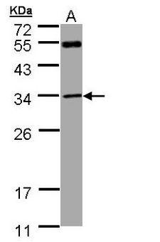 MTAP Antibody - Sample (30 ug of whole cell lysate). A: A431. 12% SDS PAGE. MTAP antibody diluted at 1:1000