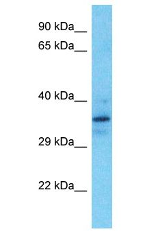 MTAP Antibody - MTAP antibody Western Blot of Jurkat. Antibody dilution: 1 ug/ml.  This image was taken for the unconjugated form of this product. Other forms have not been tested.