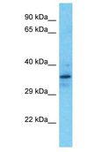 MTAP Antibody - MTAP antibody Western Blot of Jurkat. Antibody dilution: 1 ug/ml.  This image was taken for the unconjugated form of this product. Other forms have not been tested.