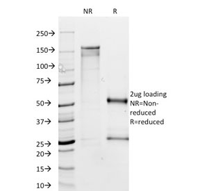 MTAP Antibody - SDS-PAGE analysis of purified, BSA-free MTAP antibody (clone MTAP/1813) as confirmation of integrity and purity.