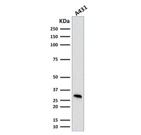 MTAP Antibody - Western blot testing of human A431 cell lysate with MTAP antibody (clone MTAP/1813). Expected molecular weight: 26-38 kDa (multiple isoforms).