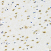 MTAP Antibody - Immunohistochemistry of paraffin-embedded rat brain using MTAP antibodyat dilution of 1:100 (40x lens).