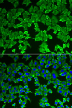 MTAP Antibody - Immunofluorescence analysis of A-549 cells using MTAP antibody. Blue: DAPI for nuclear staining.