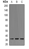 MTAP Antibody - Western blot analysis of MTAP expression in 22RV1 (A); HEK293T (B); mouse liver (C) whole cell lysates.