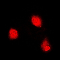 MTAP Antibody - Immunofluorescent analysis of MTAP staining in HeLa cells. Formalin-fixed cells were permeabilized with 0.1% Triton X-100 in TBS for 5-10 minutes and blocked with 3% BSA-PBS for 30 minutes at room temperature. Cells were probed with the primary antibody in 3% BSA-PBS and incubated overnight at 4 deg C in a humidified chamber. Cells were washed with PBST and incubated with a DyLight 594-conjugated secondary antibody (red) in PBS at room temperature in the dark.